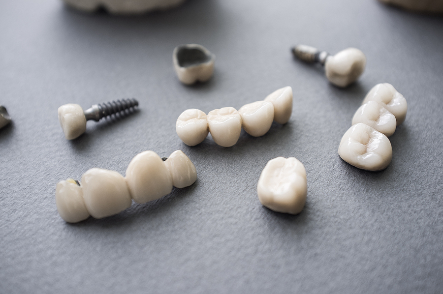 Restoring Your Smile: The Benefits of Dental Crowns in Flat Rock, NC