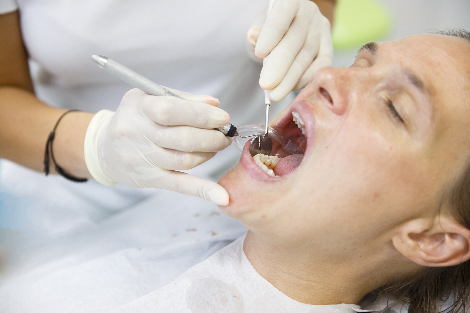 Why Dental Implants Are A Game-Changer In Restorative Dentistry?