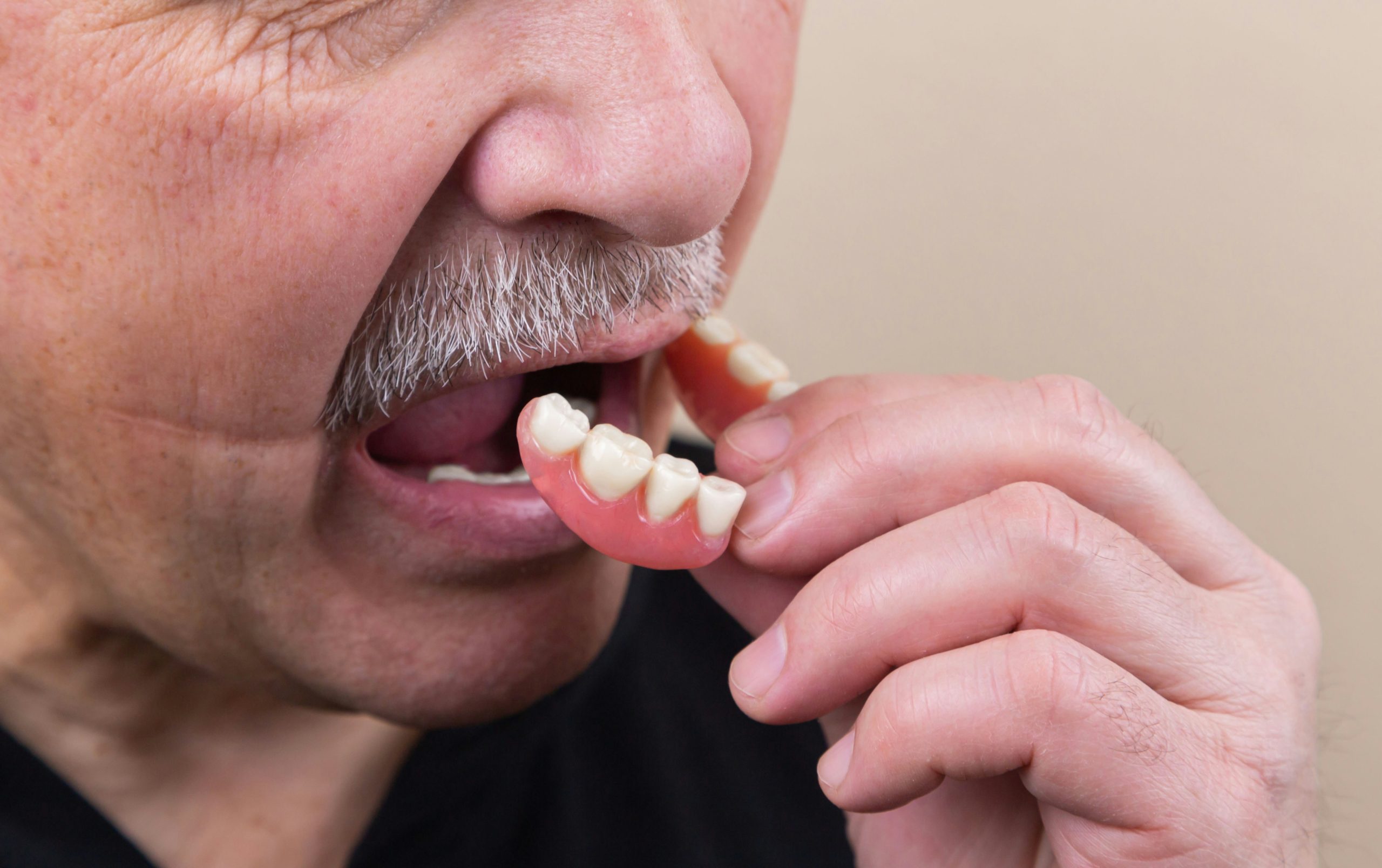 How Dentures Can Improve Your Quality of Life