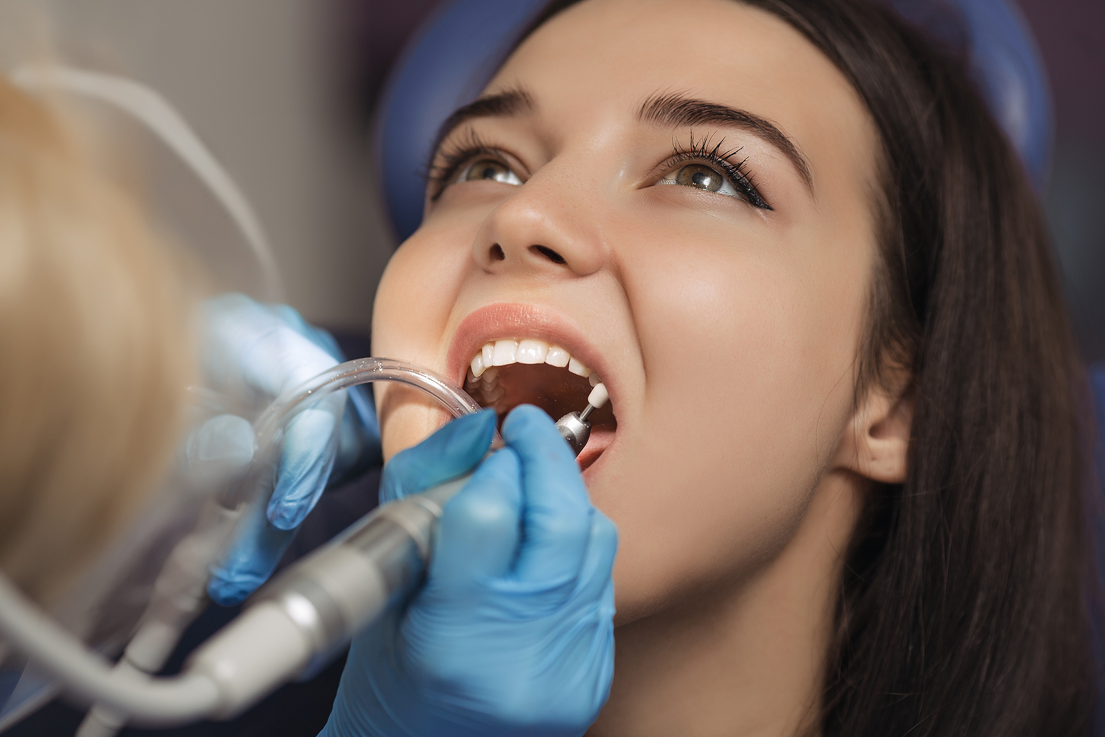 Do You Need a Root Canal? 5 Telltale Symptoms