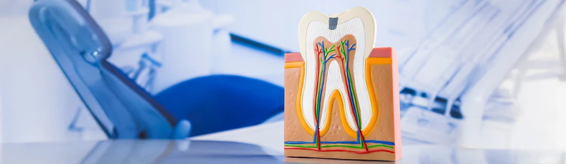 How Root Canals Save Teeth and Improve Overall Health 